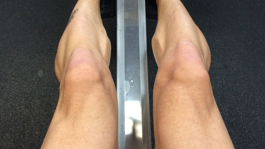 Do You Have An Acute Or Chronic Injury