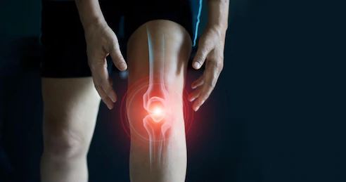 Arthritis